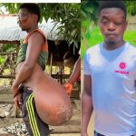 Bismark’s story is a testament to how one act of kindness can have a ripple effect not just saving a life, but restoring a future.
