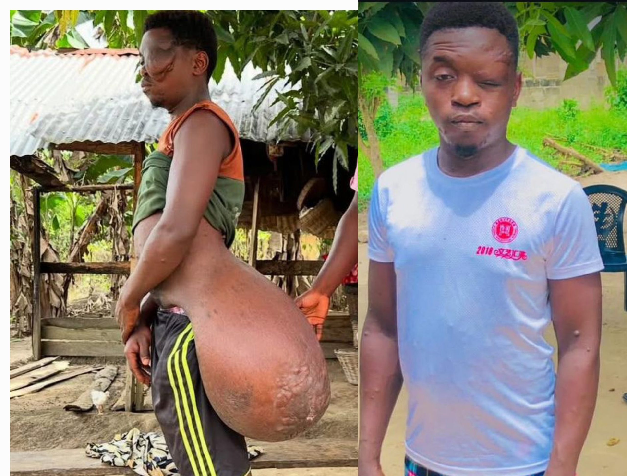 Bismark’s story is a testament to how one act of kindness can have a ripple effect not just saving a life, but restoring a future.